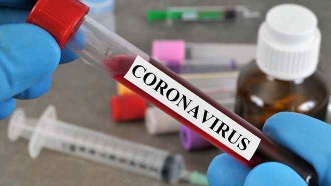 virus