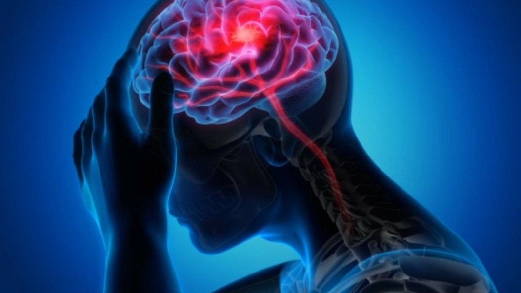Specialist neurolog: Intervenția rapidă în AVC ischemic acut este crucială, primele șase ore sunt vitale